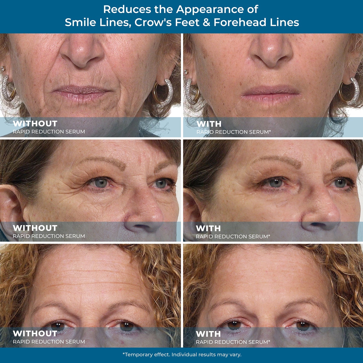 Homegood® Rapid Reduction Serum