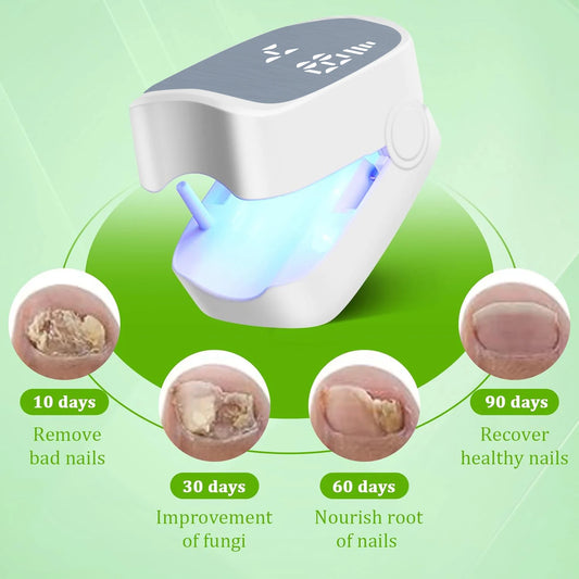 Nail Fungus Treatment LED Laser Device for Onychomycosis with USB Charging, 905nm Infrared and 470nm Blue Light for Professional Nail Care