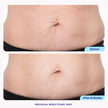 Tighten & Smooth Belly Cream