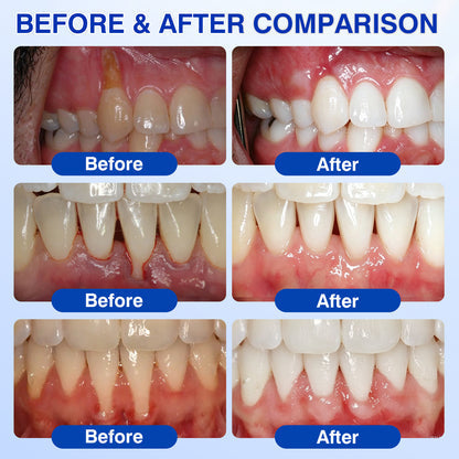 Advanced Enamel & Gum Care