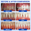 Advanced Enamel & Gum Care