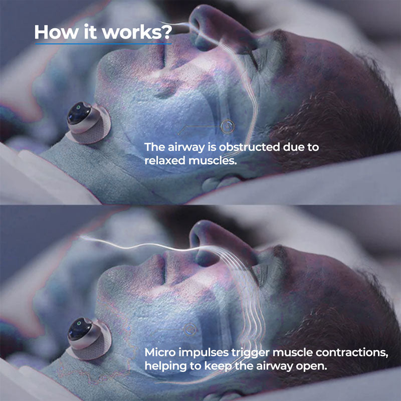 Sleep Aid | Anti-Snoring Chin Clip Device with Soft Ergonomic Design | Non-Invasive Support for Quieter Nights