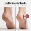 🦶Dual‑Sided Foot Callus Remover, Replaceable Stainless Steel Blade Foot Scraper